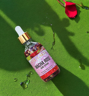 
                  
                    Load image into Gallery viewer, Macha Rose Acne Serum
                  
                