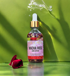 
                  
                    Load image into Gallery viewer, Macha Rose Acne Serum
                  
                